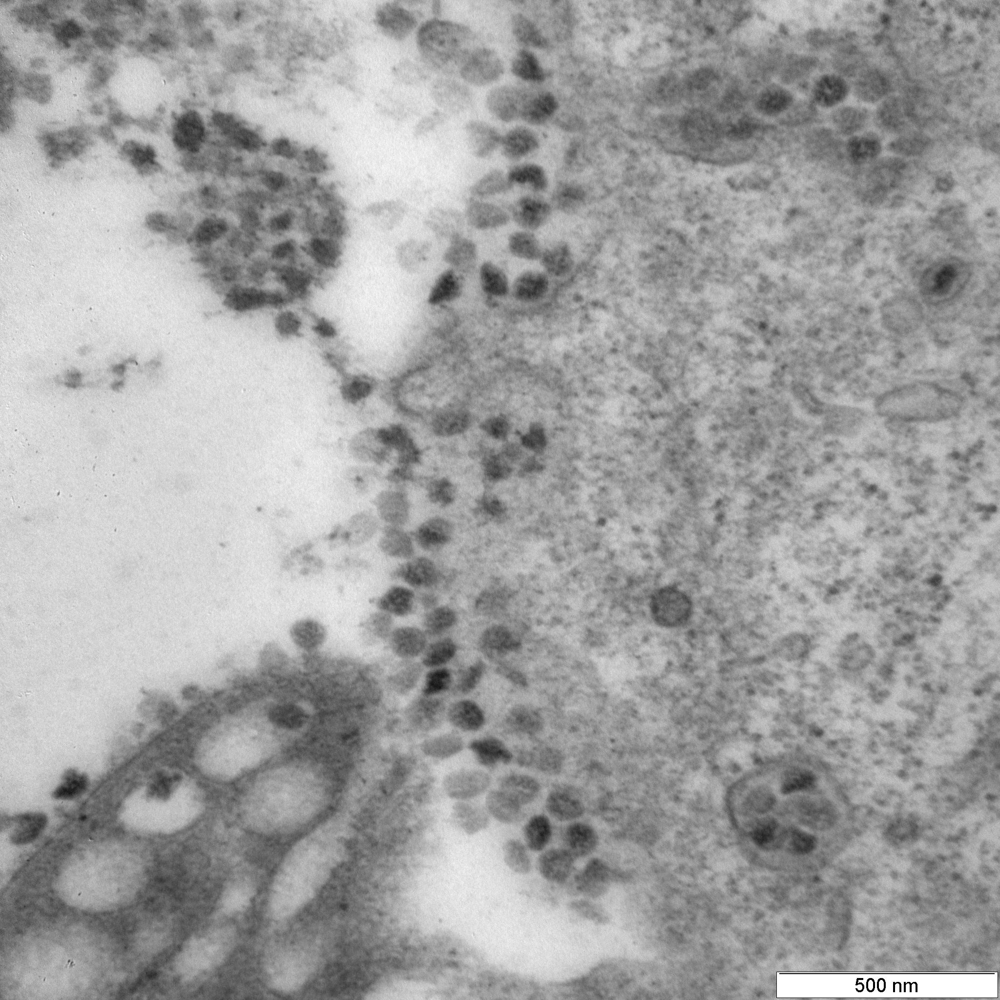 Вирусные частицы коронавируса вышли из клетки на шестые сутки с момента инфицирования и скопились на ее поверхности