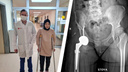 Новосибирские хирурги сделали операцию 17-летней жительнице Киргизии — одна нога у нее была короче другой на 8 см
