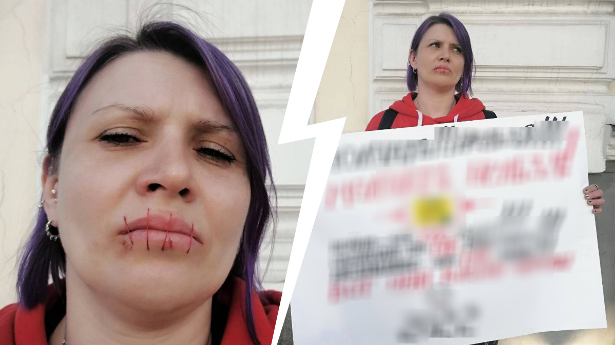 В Екатеринбурге задержали пикетчицу, которая зашила себе рот