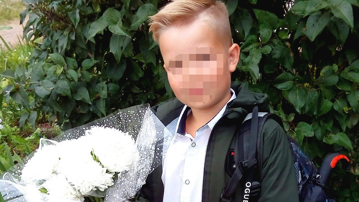 Готовится к школе: в каком состоянии мальчик из Котласского района, на которого напала собака