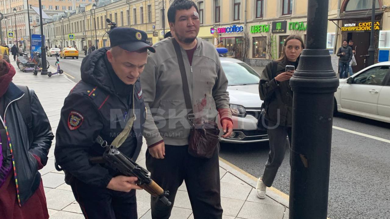 «Они избили меня бутылкой два раза». Стали известны подробности массовой драки в центре Москвы
