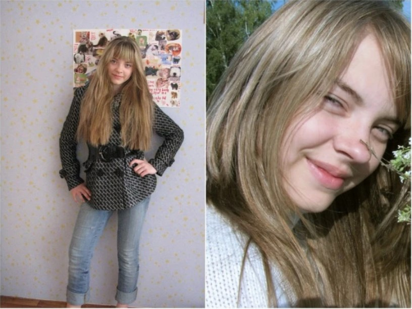 Дарья Белобровко потеряла волосы в 13 лет