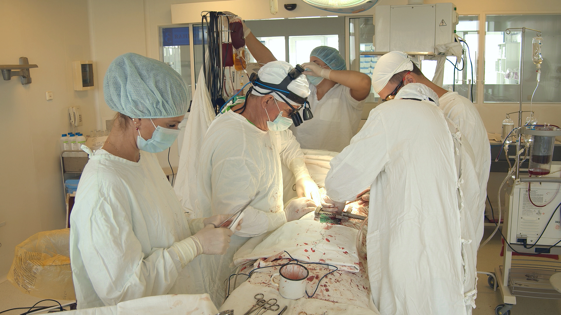 Команда врачей оперирует пациента, у которого возникли проблемы с аортой