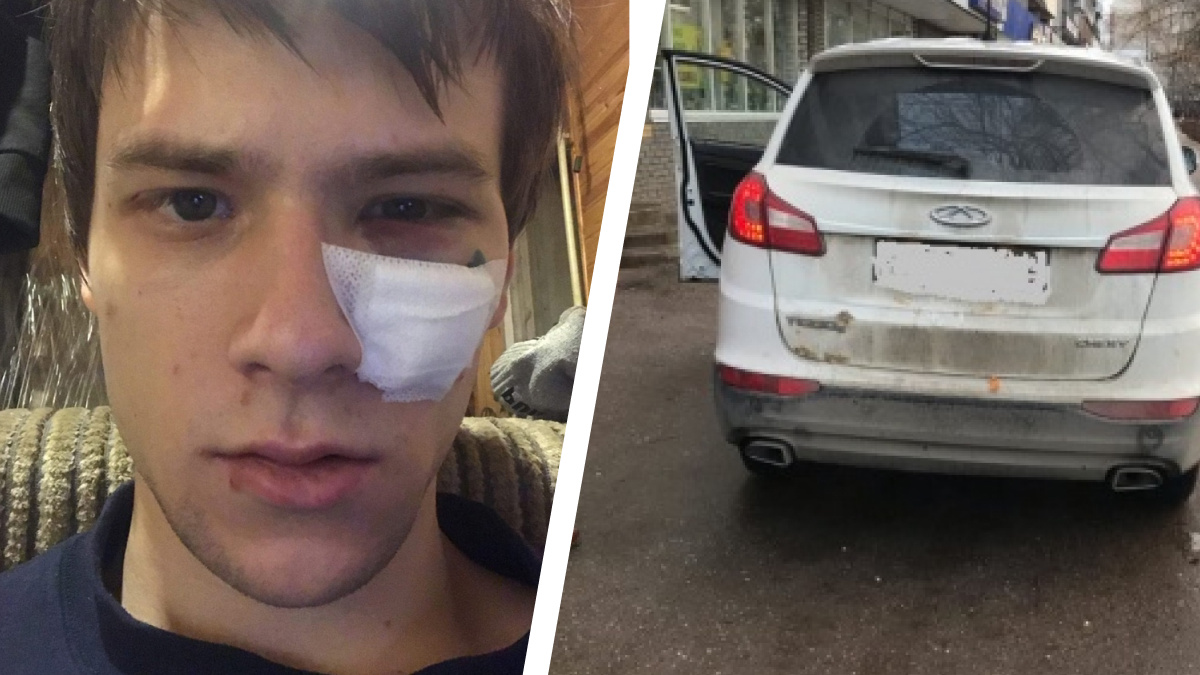 «Голова до сих пор трещит». У пешехода, который пострадал от рук водителя на Гагарина, ухудшилось зрение