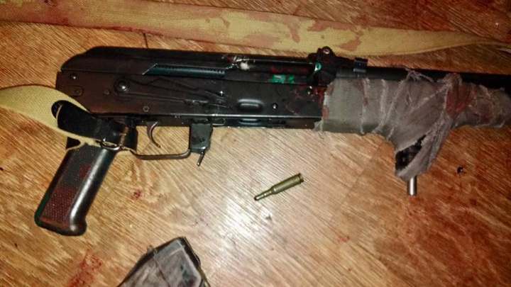 12-летняя школьница выстрелила себе в лицо из охолощенного Калашникова — она играла с оружием брата