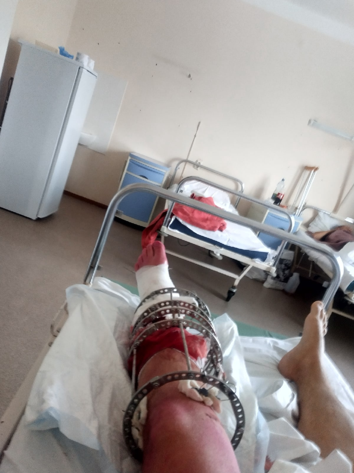 Сейчас и Павел, и Ольга — в больнице скорой помощи. У жениха — сложный перелом ноги, невеста — в реанимации Сейчас и Павел, и Ольга — в больнице скорой помощи. У жениха — сложный перелом ноги, невеста — в реанимации