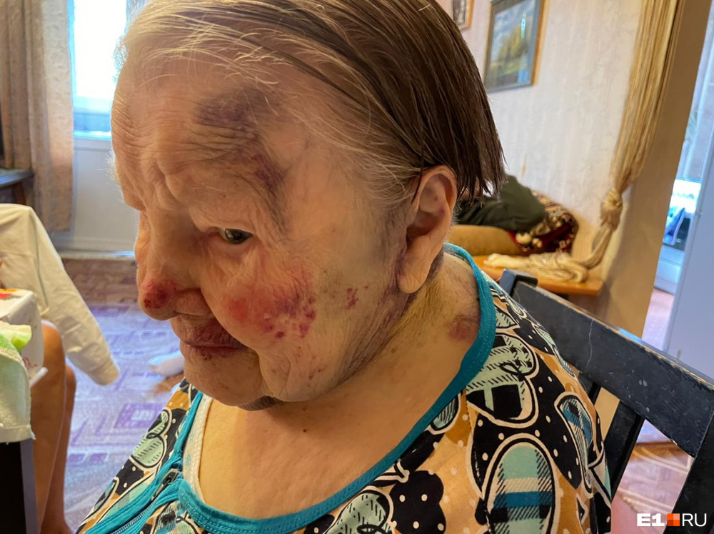 В Екатеринбурге сиделка тапкой избила 95-летнюю пенсионерку, а потом пинала ее и таскала за волосы