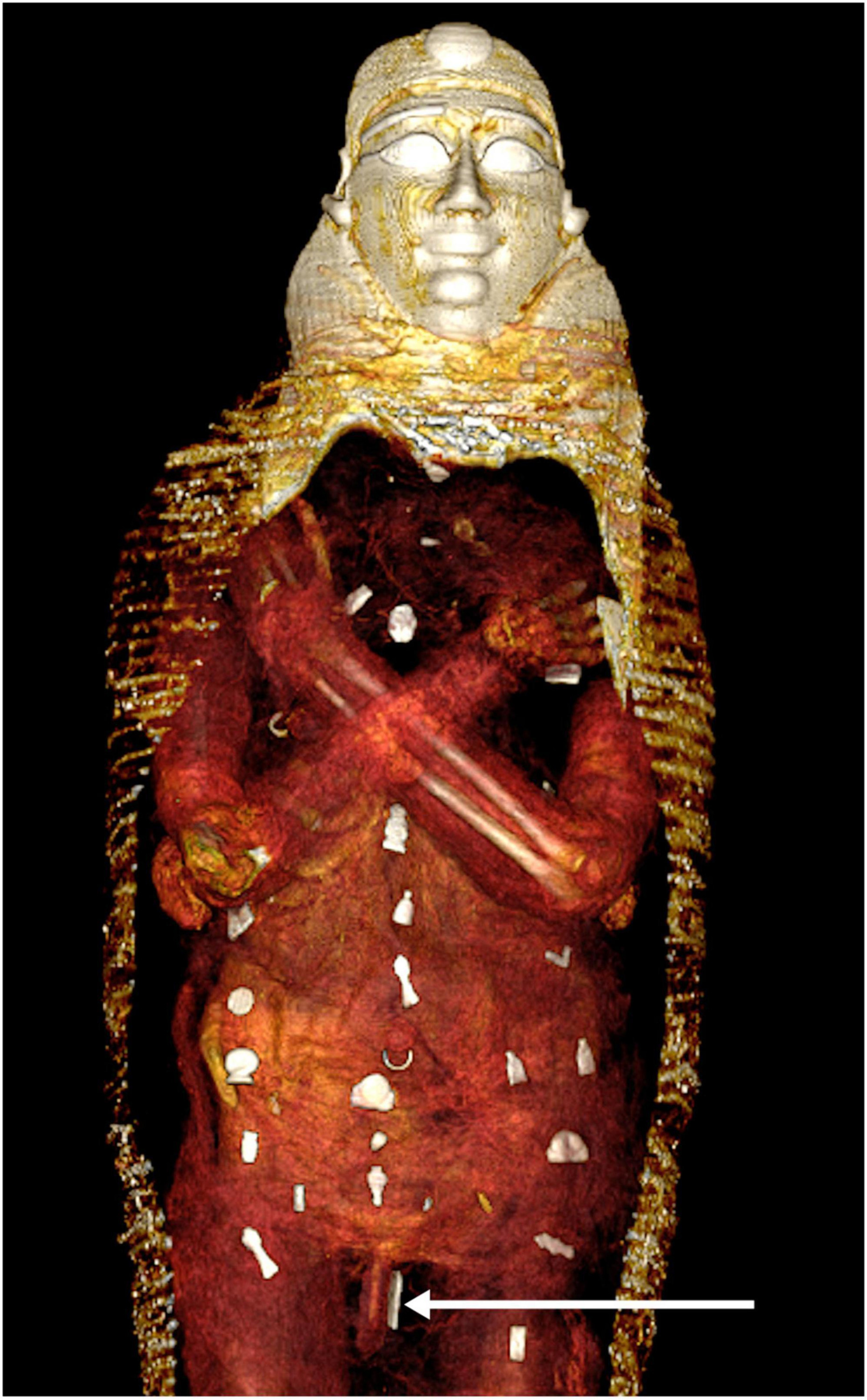 В мумии «золотого мальчика» нашли десятки драгоценностей. Она хранилась в музее более века