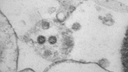 Как выглядят клетки, зараженные «омикроном»: фото ученых