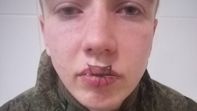 В Челябинской области свердловский солдат-срочник зашил себе рот. Что говорят его мама и девушка