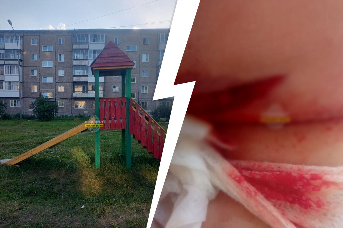 В Нижнем Тагиле маленькая девочка распорола ягодицы, напоровшись на гвоздь  в горке - 13 августа 2022 - e1.ru