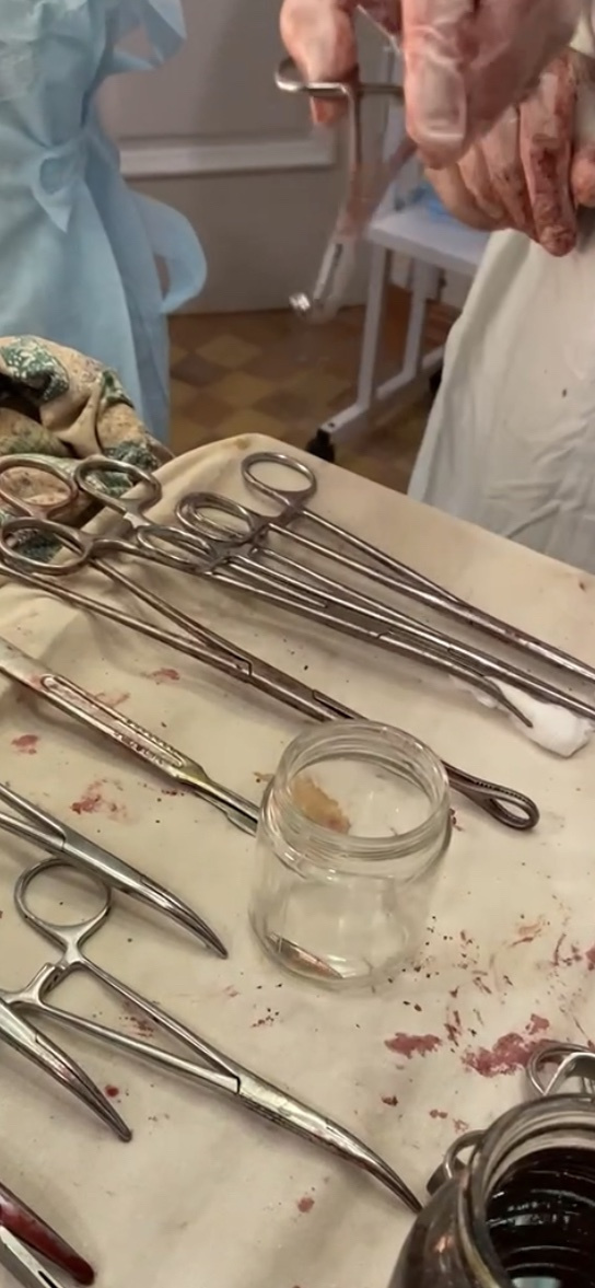 Арсенал инструментов, которыми каждый день пользовались врачи из Самарской области (и не только)