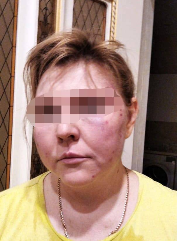Сбежав из дома, Марина попросила родителей зафиксировать следы побоев на камеру Сбежав из дома, Марина попросила родителей зафиксировать следы побоев на камеру
