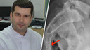 Травматолог-ортопед Курганской детской поликлиники рассказал, чем чреваты переломы копчика у детей