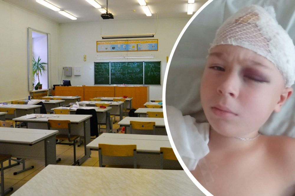 Мальчика, разбившего голову в школе Асбеста, выписали из больницы. В понедельник он снова пойдет к врачу