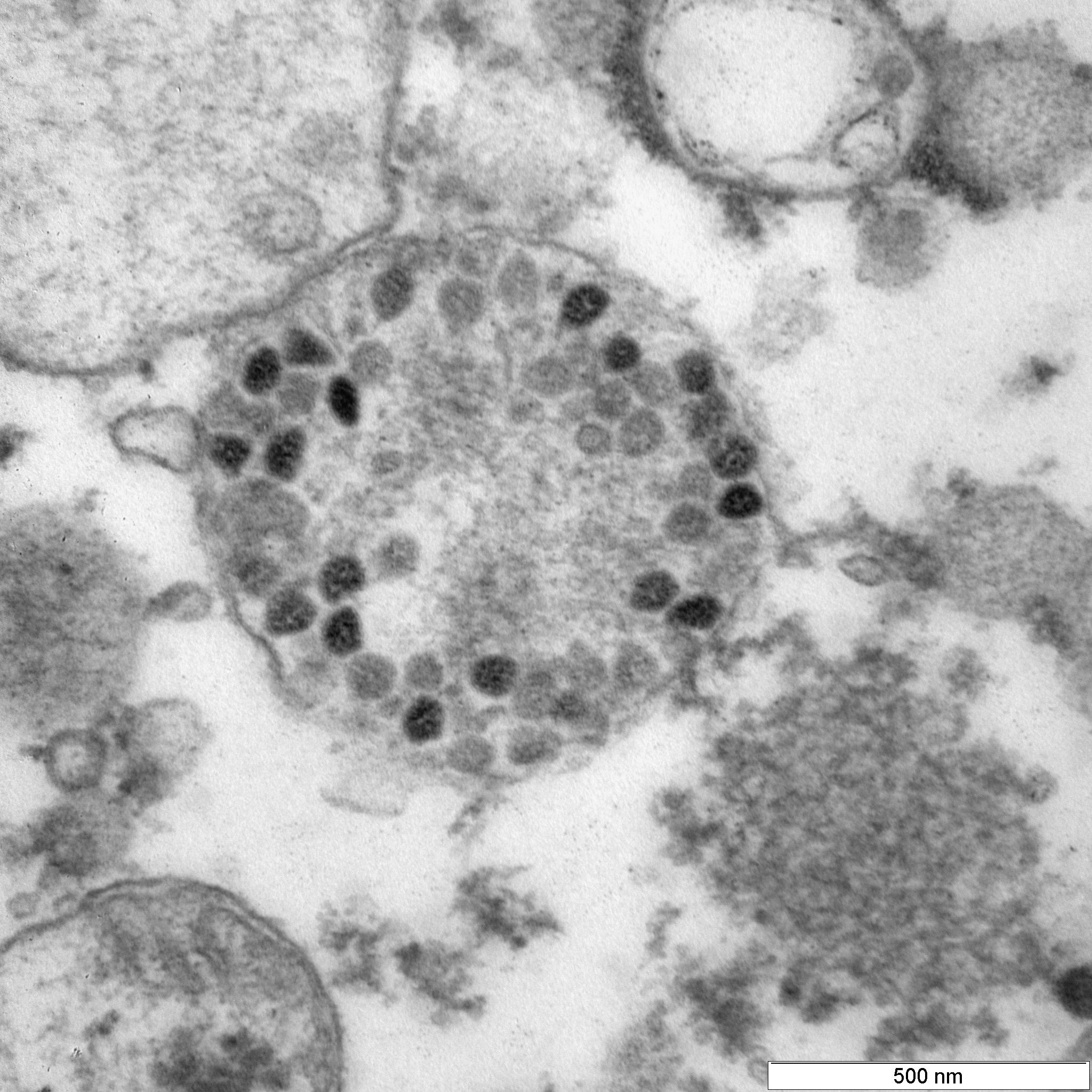 6-е сутки инфекции. Вирусные частицы коронавируса (штамм «омикрон») разнообразной формы в пузырьках эндоплазматической сети клеток Vero Е6.