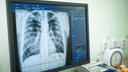 В России будут по-новому диагностировать туберкулез у детей