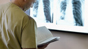 Онколикбез: почему рак лёгких трудно обнаружить и нужно ли проходить флюорографию