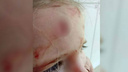 Снова ЧП в «Ауре»: девочка рассекла голову на аттракционе
