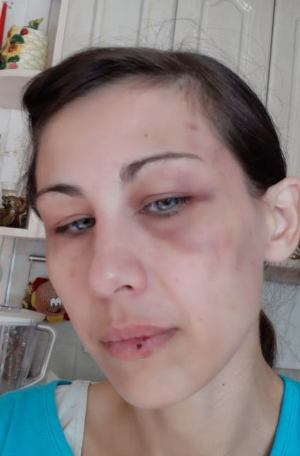 Муж уверяет, что его жена-хирург сама подралась с подругой