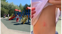 Ребёнок поранил спину на новой детской площадке сквера Славы