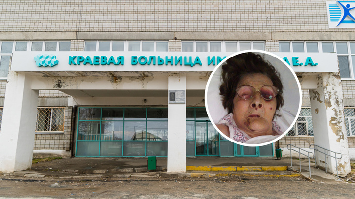 У пациентки больницы Березников после госпитализации появились синяки. Родственники винят врачей