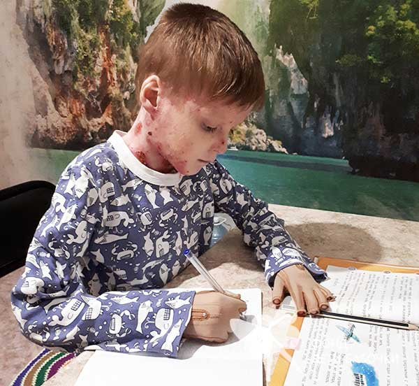 Когда позволяет состояние, Максим ходит в школу, но сейчас из-за пандемии коронавируса занимается на дому Когда позволяет состояние, Максим ходит в школу, но сейчас из-за пандемии коронавируса занимается на дому