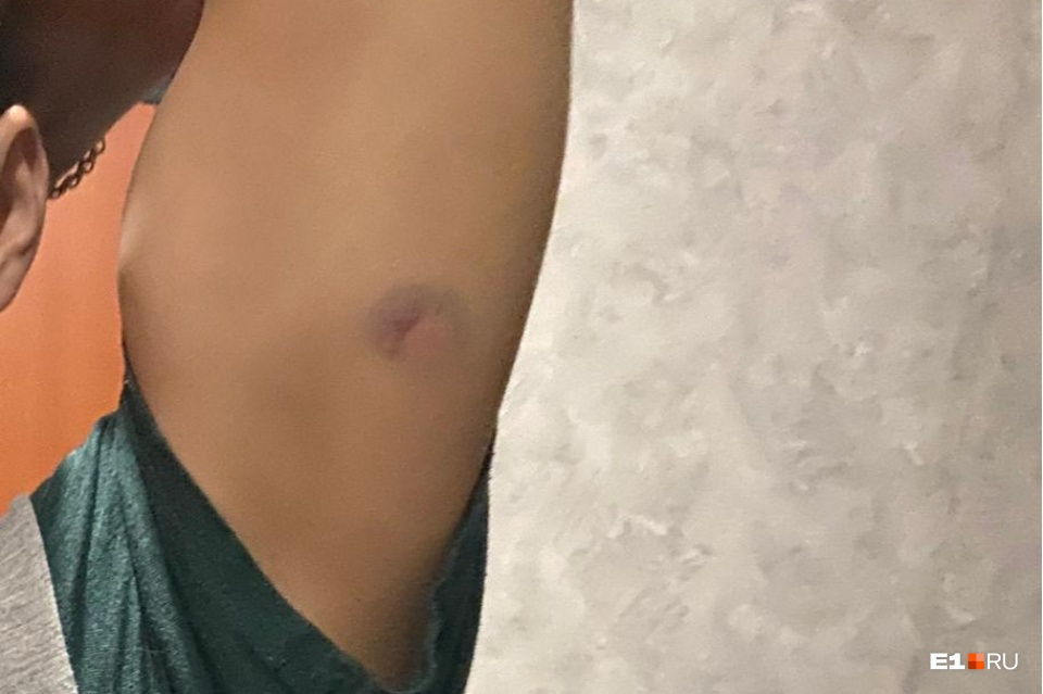 По словам участников перепалки, в водителя Daewoo попали из пистолета По словам участников перепалки, в водителя Daewoo попали из пистолета