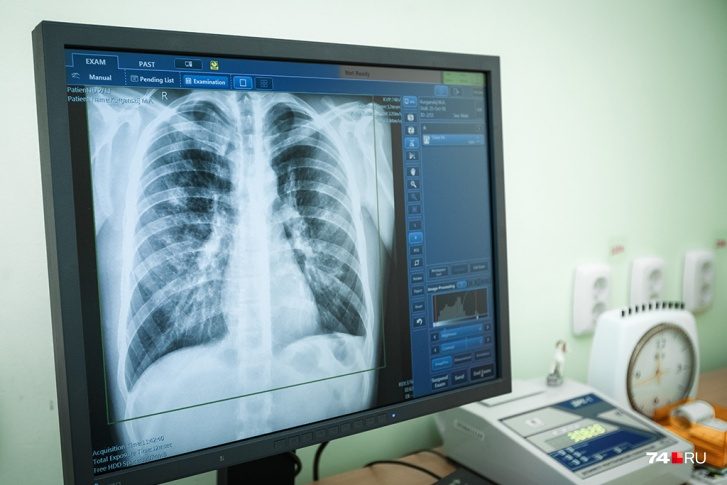 Цифровая флюорография (рентгенография легких) - Клиника Новая Медицина в Орехово-Зуево