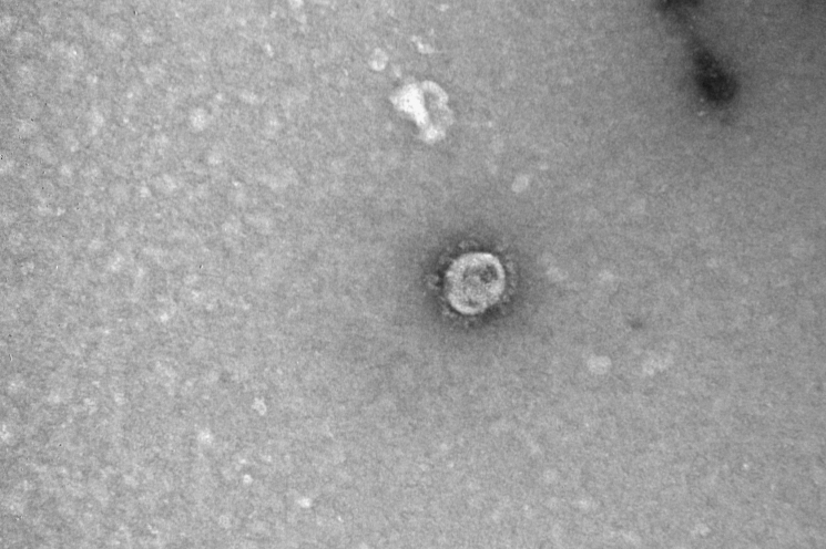 Вот он, голубчик коронавирус. Еще больше <a href="https://ufa1.ru/text/health/69039724/" target="_blank" class="_">фотографий по ссылке</a> Вот он, голубчик коронавирус. Еще больше <a href="https://ufa1.ru/text/health/69039724/" target="_blank" class="_">фотографий по ссылке</a>
