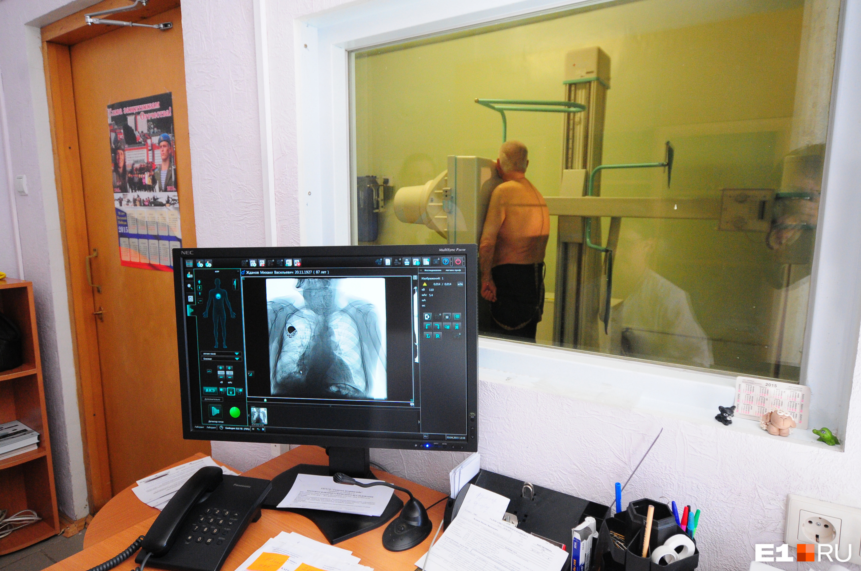 Если на снимке флюорографии будут заметны изменения в легких, пациента направляют на дополнительное обследование