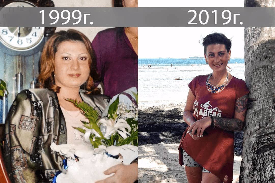 Антонина похудела на 30 кг, но страх лишнего веса остался