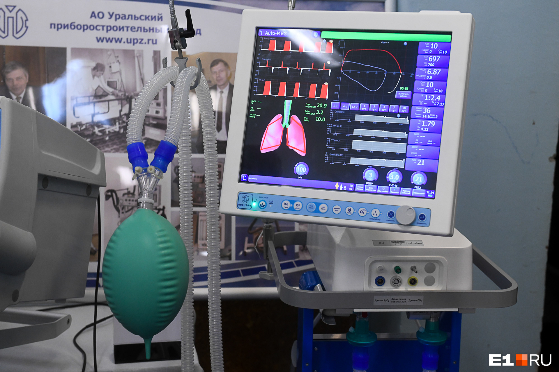 Аппарат ИВЛ анализирует процессы, которые происходят в дыхательной системе