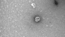 Российские ученые сфотографировали коронавирус. Посмотрите на него