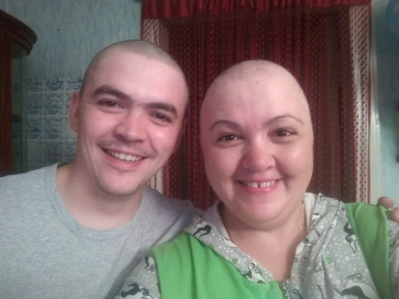 Во время химиотерапии Наталья потеряла волосы. Ее брат тоже побрился налысо — в знак поддержки