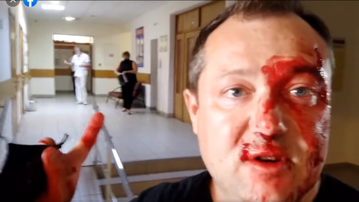 Журналист Дмитрий Полушин заявил об избиении в избиркоме