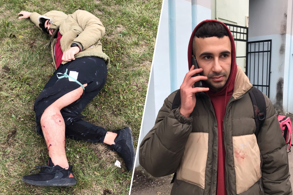 Друг Ашрафа Абдула получил ранения Друг Ашрафа Абдула получил ранения