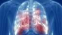 Коронавирус повышает риск заболеть туберкулезом. Список опасных и подозрительных симптомов