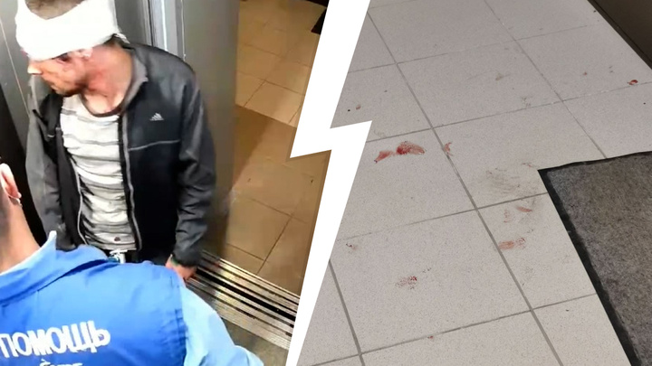 «Коридор весь в крови»: екатеринбурженка, подравшаяся с парнем в лифте, вновь его избила