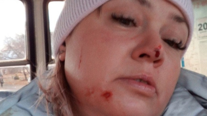 «Била руками и ногами»: в Магнитогорске пассажирка трамвая заявила о нападении кондуктора из-за маски