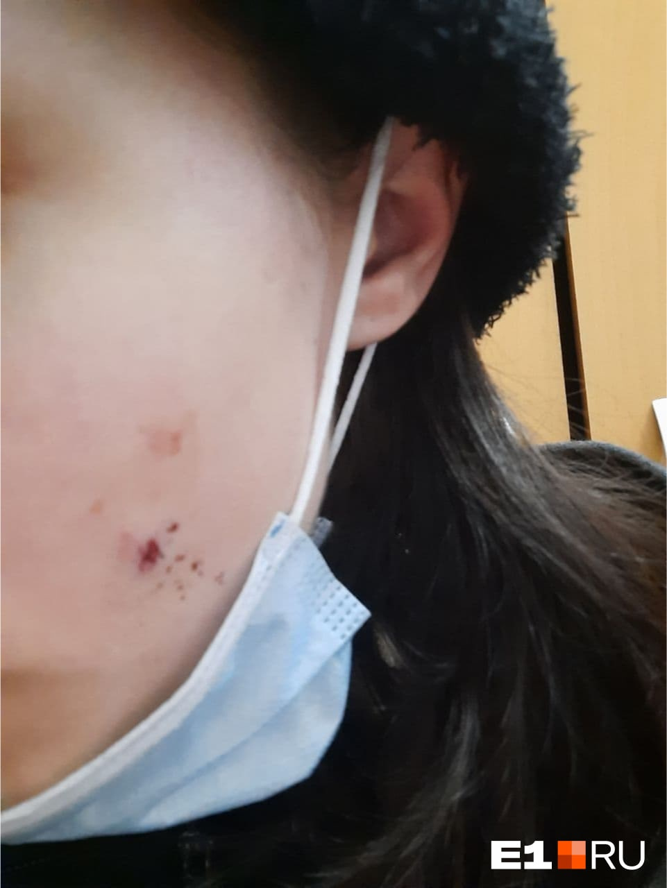 Ее ударили лицом о боковое стекло «Приоры» Ее ударили лицом о боковое стекло «Приоры»