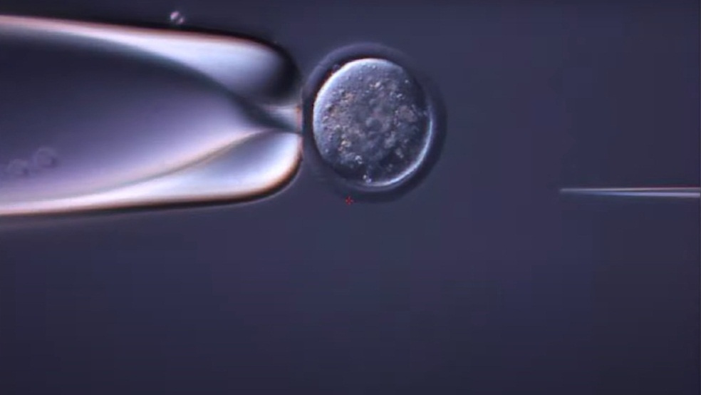Так прокалывали эмбрион мыши