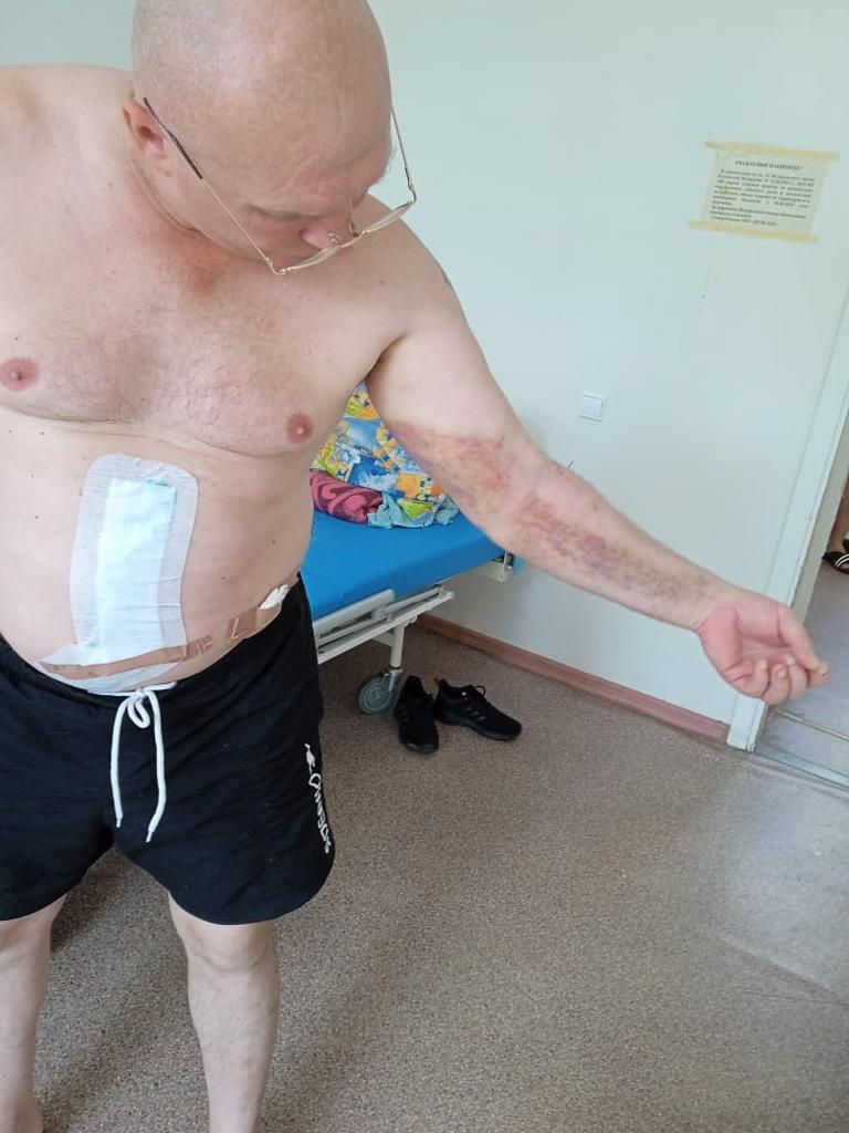 Нападавший повредил нерв на руке Сергея, на следующей неделе ему предстоит операция