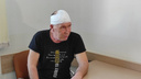 «Человек снимает шапку, а перед <nobr class="_">ним —</nobr> вторая голова»: в Новосибирске спасли пациента с опухолью на лбу