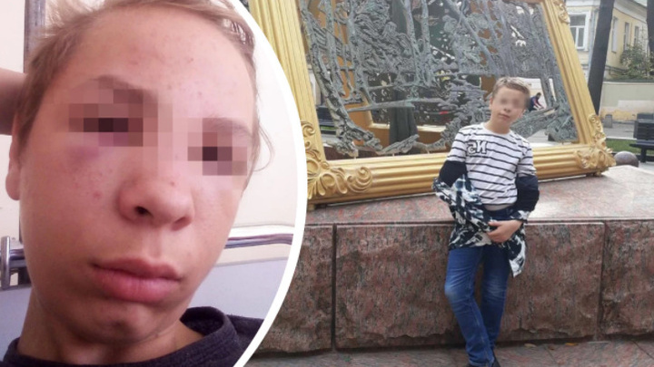 «Не понравилось, что смеялись»: в Ярославской области задержали мужчину, который напал на подростка