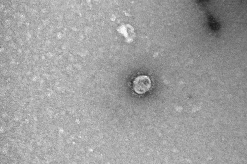 Так выглядит новый коронавирус под микроскопом