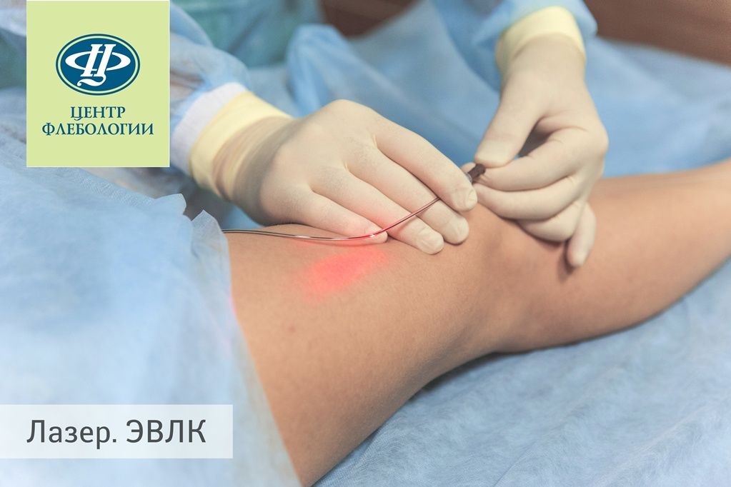 varikoz.ru varikoz.ru