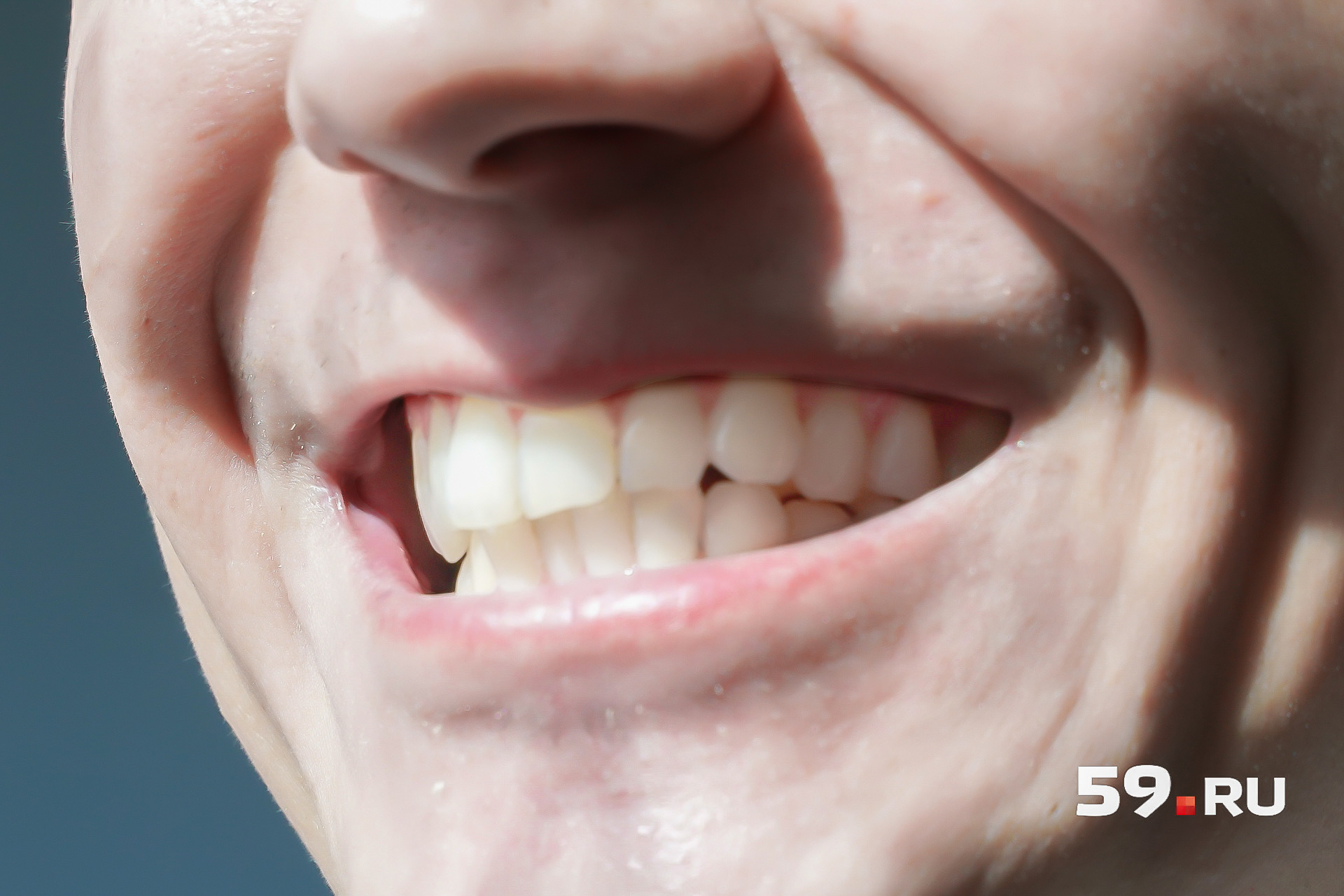 Эти зубы белые от природы. Как нам рассказал врач, здоровые зубы могут быть разных цветов