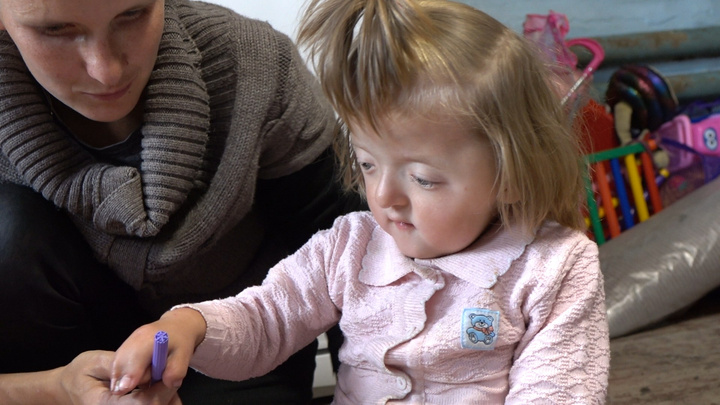 Девочку со сросшимися пальцами отправили под наблюдение генетиков медцентра в Уфе