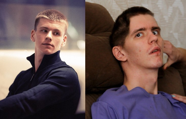 Иван до и после травмы
